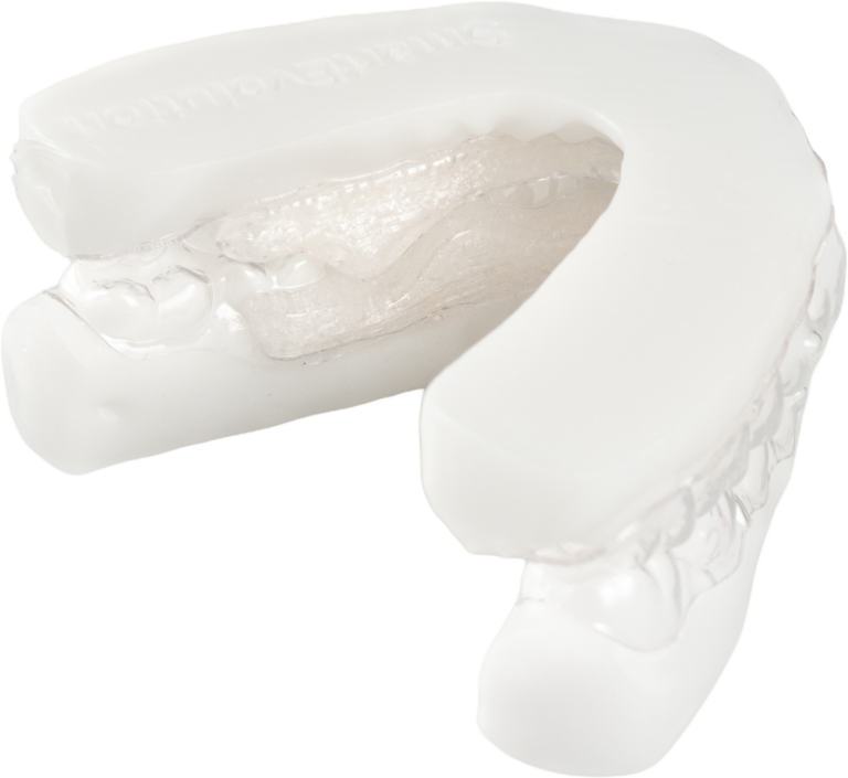 Advanced Kit su modello dentale