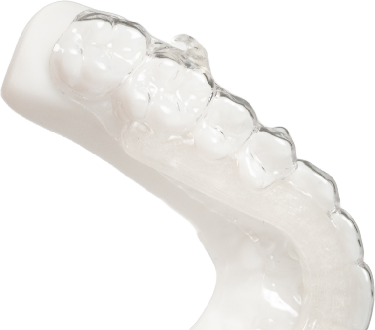 Traction Kit: allineatore trasparente su modello dentale